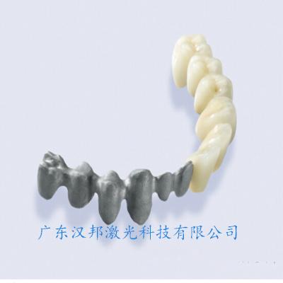 牙科种植金属3D打印